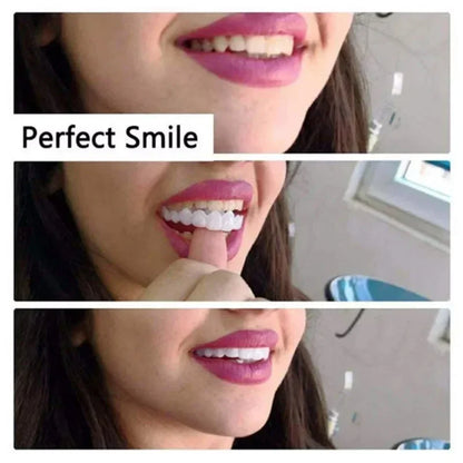 Snap-on Teeth Veneers Braces Box Kit, Snap-on Fake Teeth Veneers Braces Box Teeth Whitening Dental Care for Adults