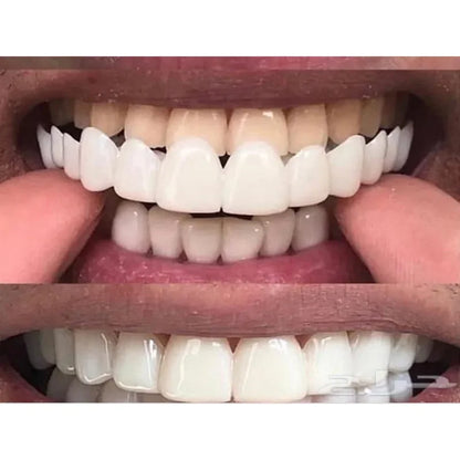 SowSmile Silicone Gel Perfect Smile Dental Hygiene Upper Lower Fake Teeth Cover Veneers Dentures Braces Whitening Products Mold
