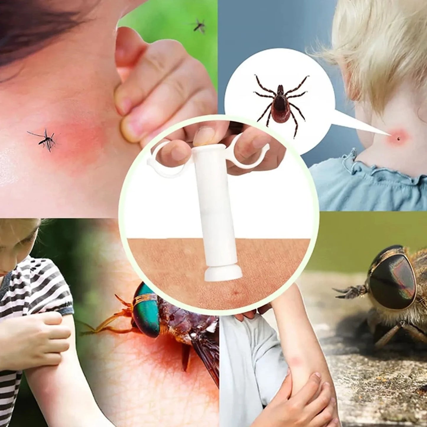 Bug Bite Suction Tool, Venom Extractor Itch Relief, Natural Reduce Itch & Swell, Bite & Sting First Aid for Outdoor Hiking, Back
