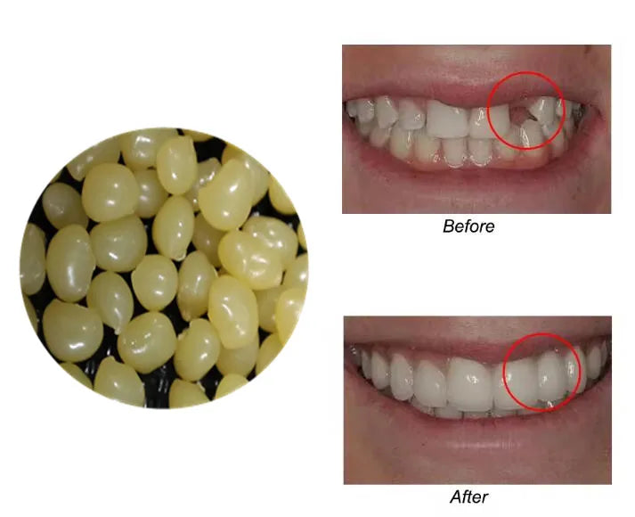 4 Colors Dental Oral False Fake Teeth Tooth Filling Repair Smile Snap on Veneers Dentures Case Paste Adhesive Beads Cosmetic
