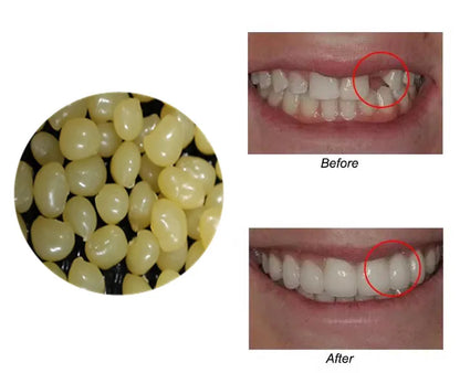 4 Colors Dental Oral False Fake Teeth Tooth Filling Repair Smile Snap on Veneers Dentures Case Paste Adhesive Beads Cosmetic