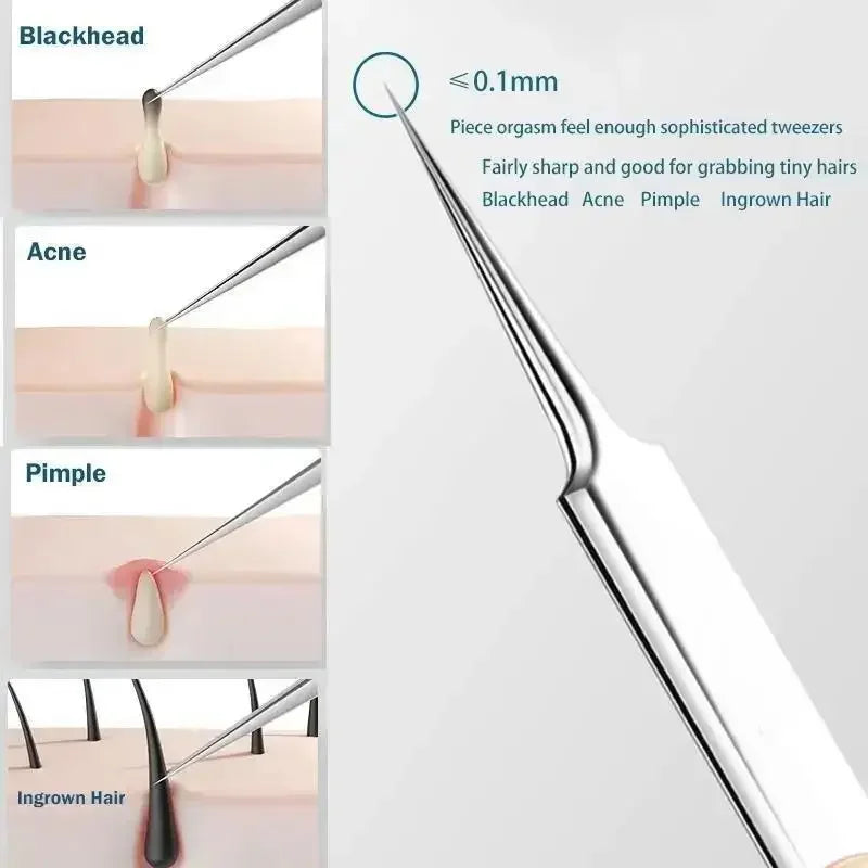 11Pcs/Set Acne Needle Blackhead Clip Remover Extraction Pore Black Head Cleaner Face Skin Care Cleansing Needle Tool Cell Clamp