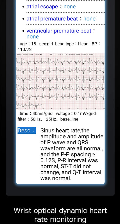 ECG+PPG Smart Wristband Fitness Tracker for Women Men Calorie Blood Pressure Waterproof Sport Smartband Health Smartwatch