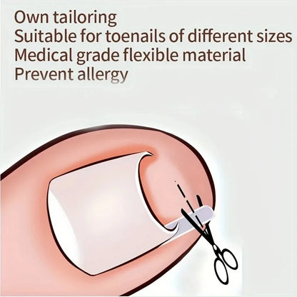 50Pcs Ingrown Toenail Correction Tool Invisible Ingrown Toe Nail Treatment Pad Groove Straightening Clip Brace Foot Care Tool