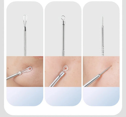 Stainless Steel 4/7/8pcs Acne Removal Tool Set - Blackhead & Pimple Popper Kit for All Skin Types, Fragrance-Free, Beauty Tools
