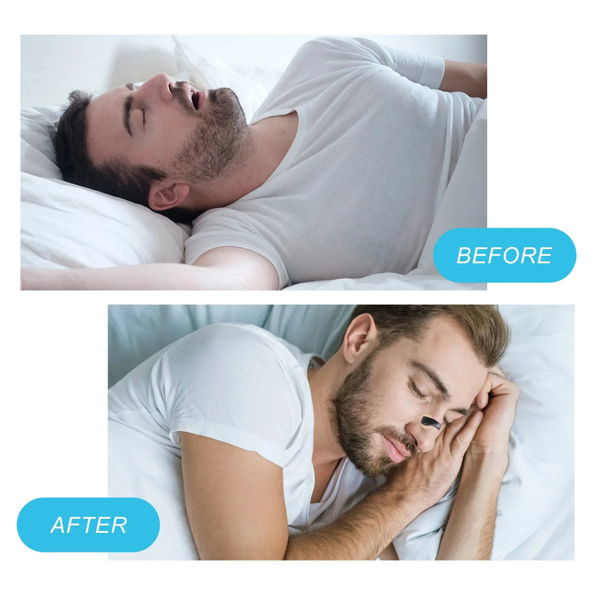 Nose Breathing Patches Suction Iron Tabs Magnetic Nasal Strips Increase Sports Air Intake Improve Sleeping Reduce Snoring Tools