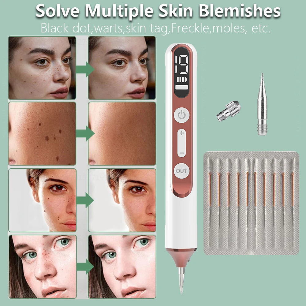Plasma Pen Skin Tag Remover Mole Removal Wart Spots Dark Dpot Black Dot Nevus Freckle Flat Blemish Pimples Removal for Face Body