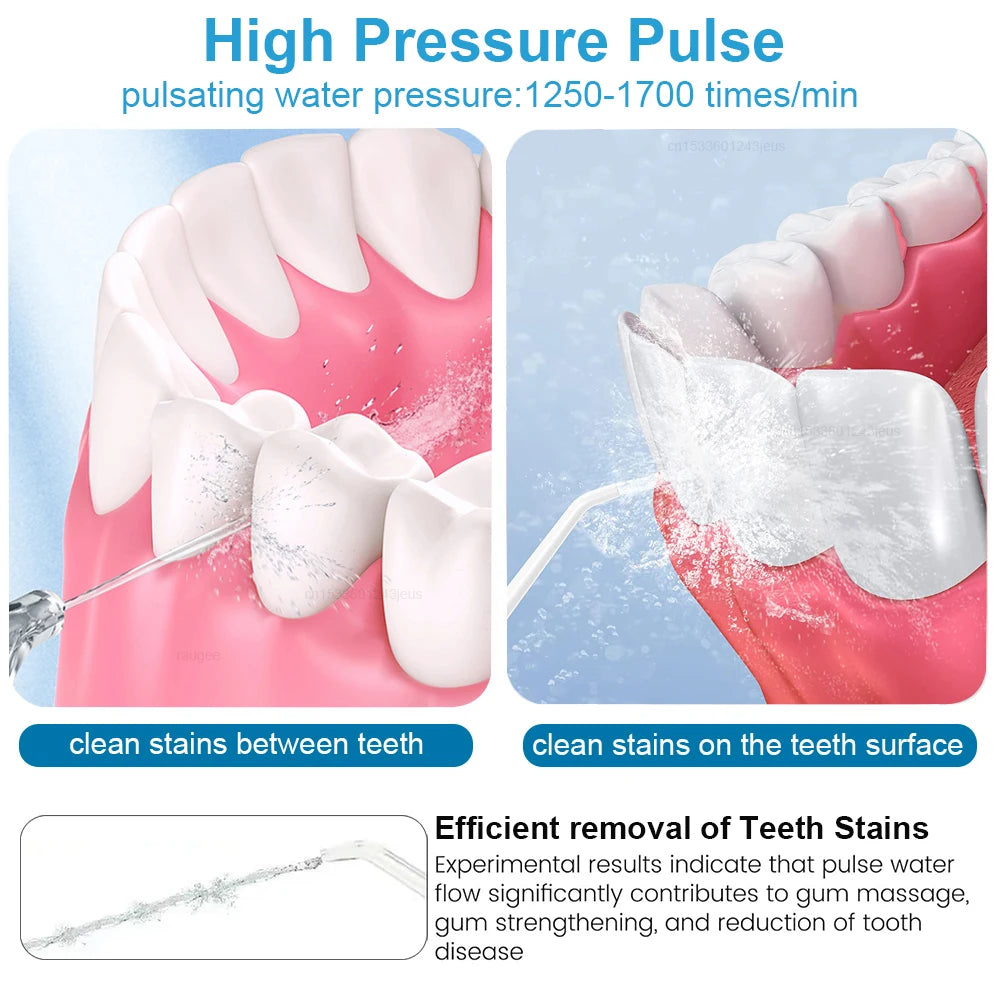 Oral Irrigator Dental Water Flosser for Teeth High Pressure Electric Dental Irrigator Water Flosser Mouth Washing Machine 800ML