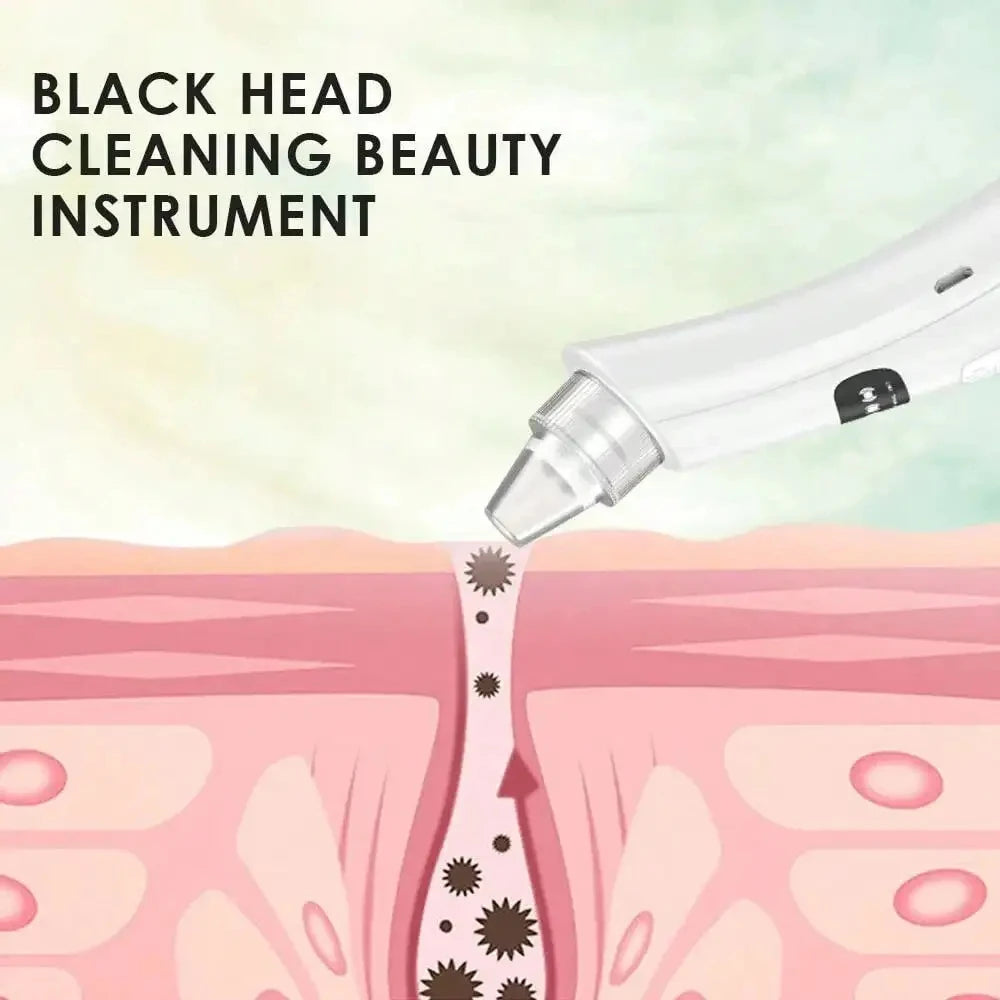 3-Suction Mode Vacuum Pore Cleaner, Facial Cleansing Device for Removing Blackheads & Dead Skin