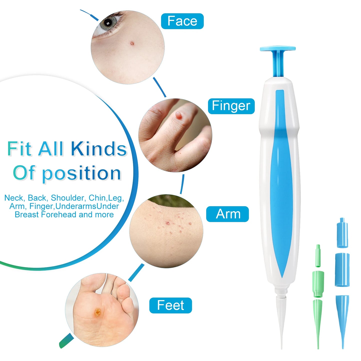 Skin Tag Removal Mole Wart Removal Facial Mole Wart Microstrip Tag Removal Kit Automatic Mole Remover Tool with Cleansing Swabs