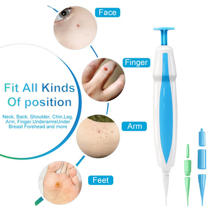 Skin Tag Removal Mole Wart Removal Facial Mole Wart Microstrip Tag Removal Kit Automatic Mole Remover Tool with Cleansing Swabs