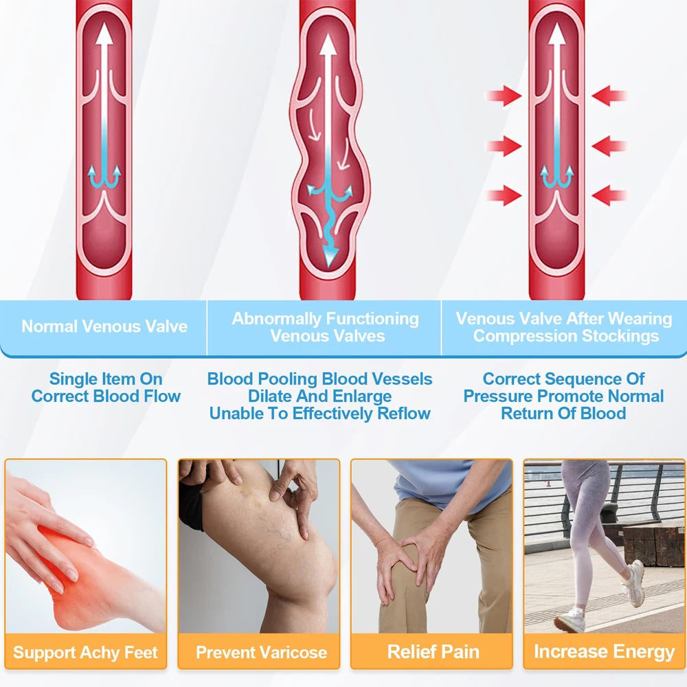 1Pair  Ted Hose Thigh High Anti Embolism Compression Stockings for Women & Men, Surgical Compression Stockings, 15-21 mmHg