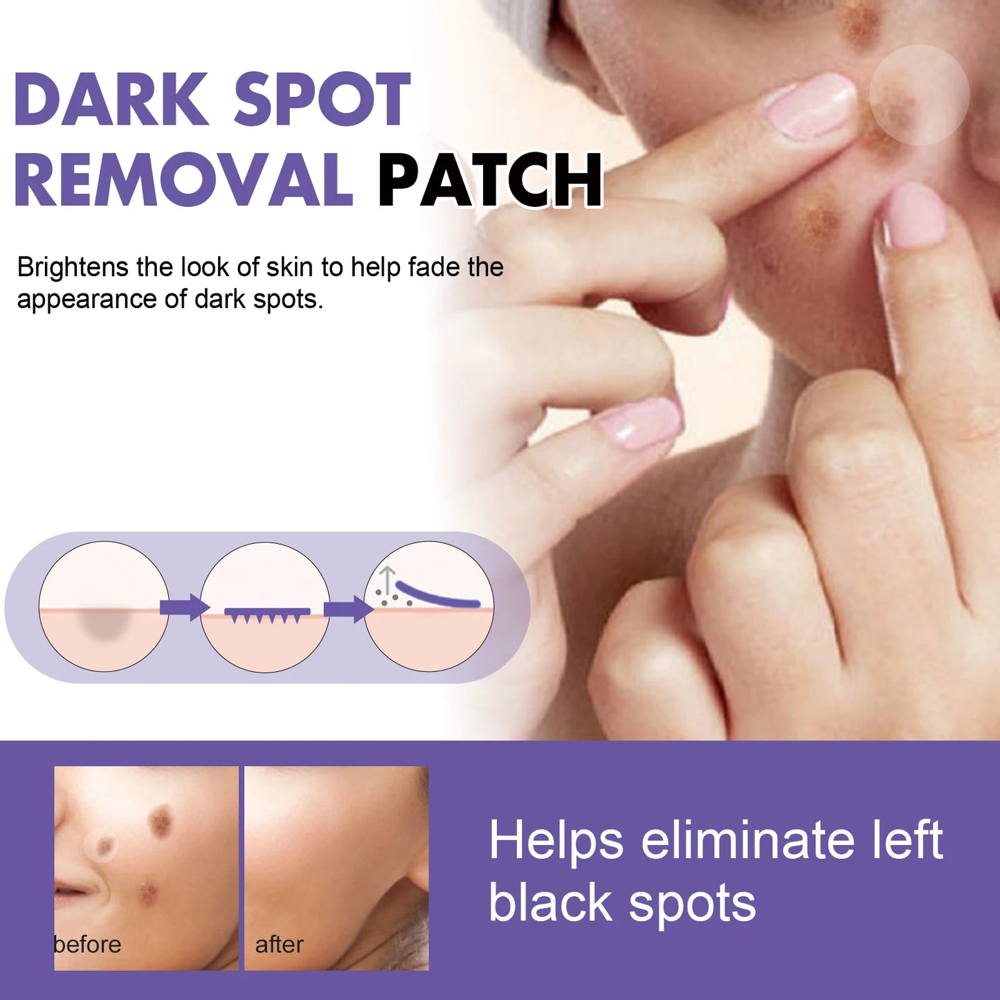 Spot-removing patches - for lightening facial dark spots, chloasma, pigmentation andmelanin; moisturizing skin. spot patches