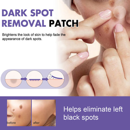 Spot-removing patches - for lightening facial dark spots, chloasma, pigmentation andmelanin; moisturizing skin. spot patches