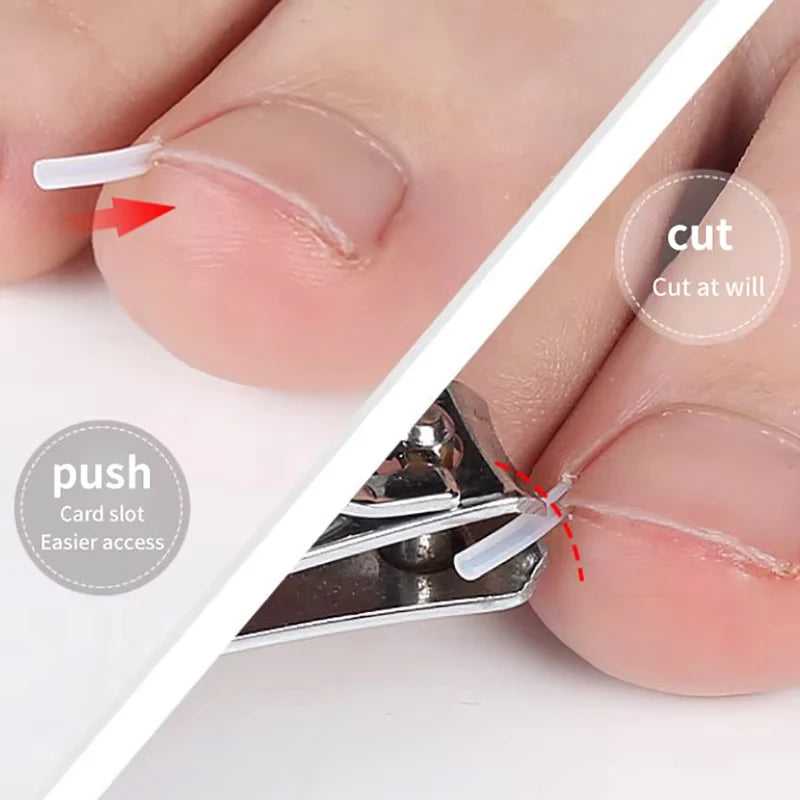 50Pcs Ingrown Toenail Correction Tool Invisible Ingrown Toe Nail Treatment Pad Groove Straightening Clip Brace Foot Care Tool