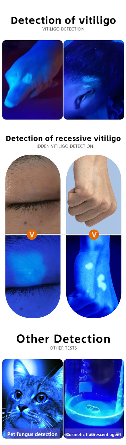 NEW Woods Lamp Skin Analyzer Portable Facial Salon Beauty Analyzer UV Lamp Wood Dermatology for Analyzing Testing Examination