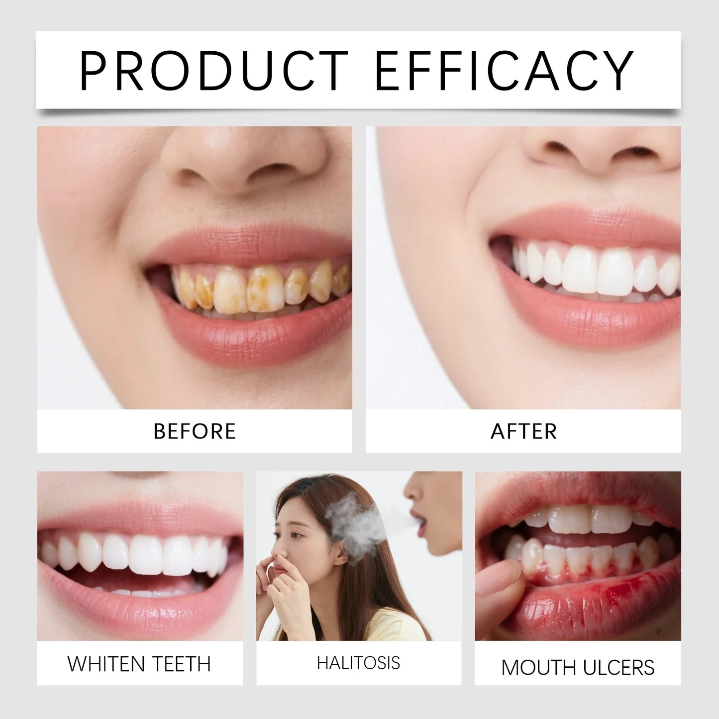 Tooth Polish Pen Dental Whitener Remove Stains Reduce Yellowing Teeth Gums Treatment Fresh Breath Tooth Brightening Serum
