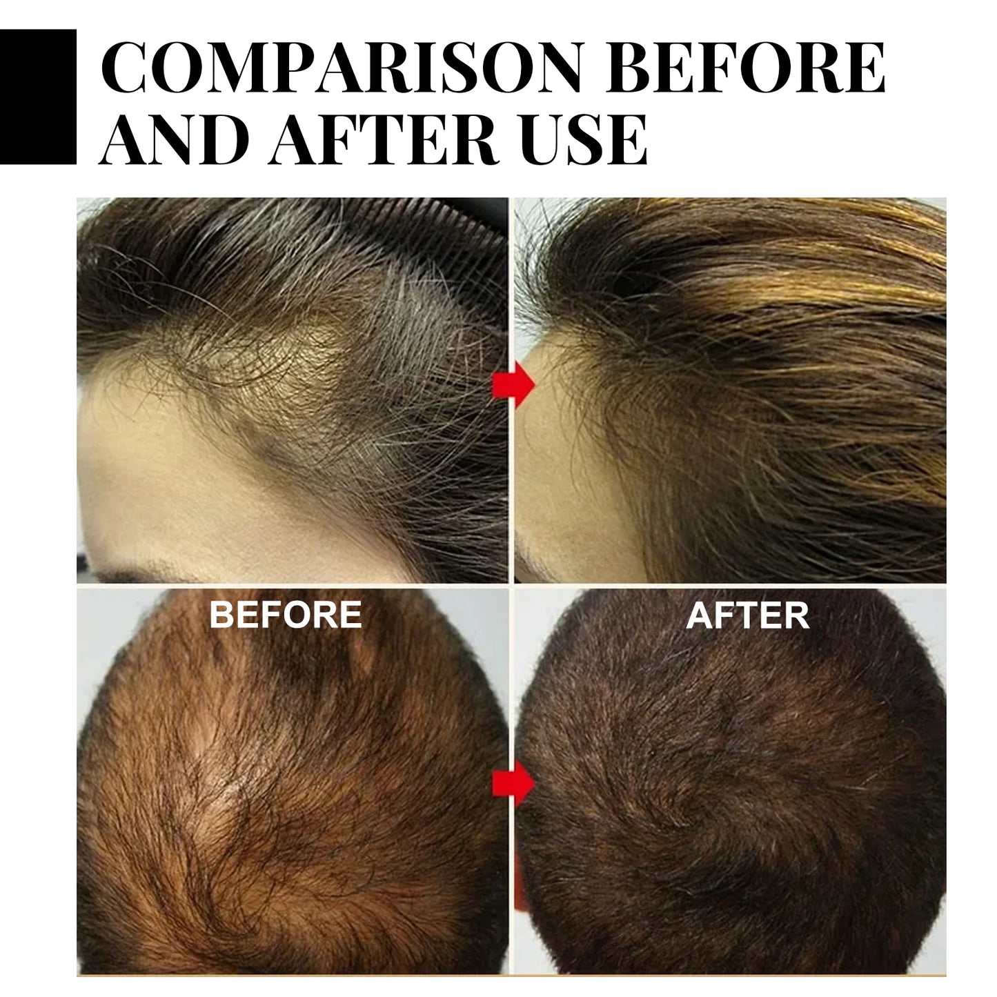 Volumizing Hair Powder Long-Lasting Oil Control Fluffy Hair Powder Increase Hair Volume Enhancing Styling Hair Treatment Salon