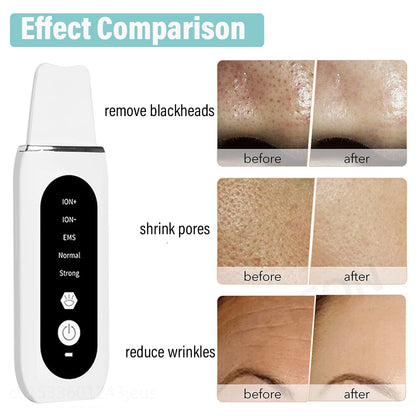 Ultrasonic Skin Scrubber Facial Peeling Face Scrubber Blackhead Remover Ance Pore Deep Facial Cleaning Spatula Facial Cleanser