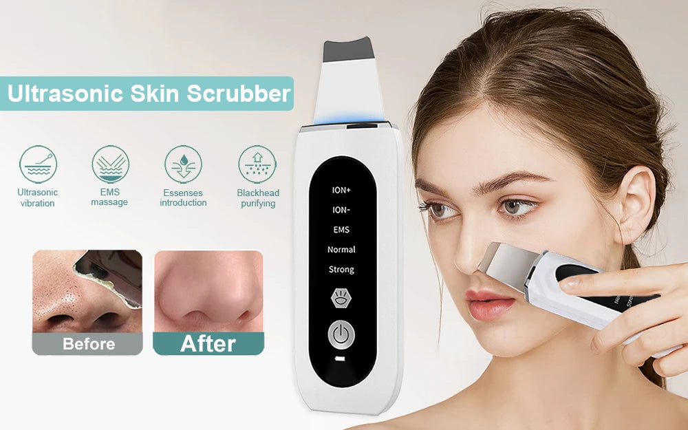 Ultrasonic Skin Scrubber Facial Peeling Machine Black Dots Acne Pore Deep Cleaning Ultrasonic Face Scrubber Blackhead Remover