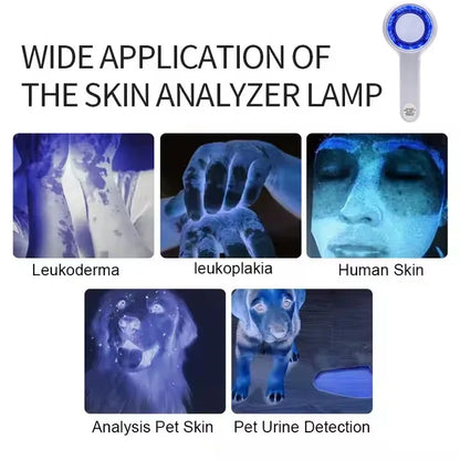 NEW Woods Lamp Skin Analyzer Portable Facial Salon Beauty Analyzer UV Lamp Wood Dermatology for Analyzing Testing Examination