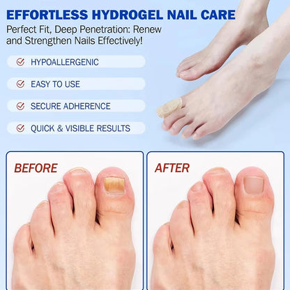 Nail Fungus Patch Waterproof Nail Repair Patch Ingrown Correction Sticker Damaged Nail Gray Care Patch Feet Care Tools