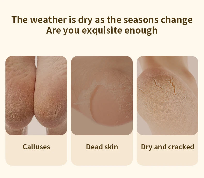 HOMEFISH Electric Foot Grinder Automatic Foot Callus Rubbing Pedicure Dead Skin Callus Remover for Foot Rechargeable Foot Beauty