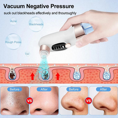 Blackhead Remover Pore Vacuum Cleaner Multifunctional Cleaning Instrument Small Bubble Facial Cleasing Machine Beauty Device