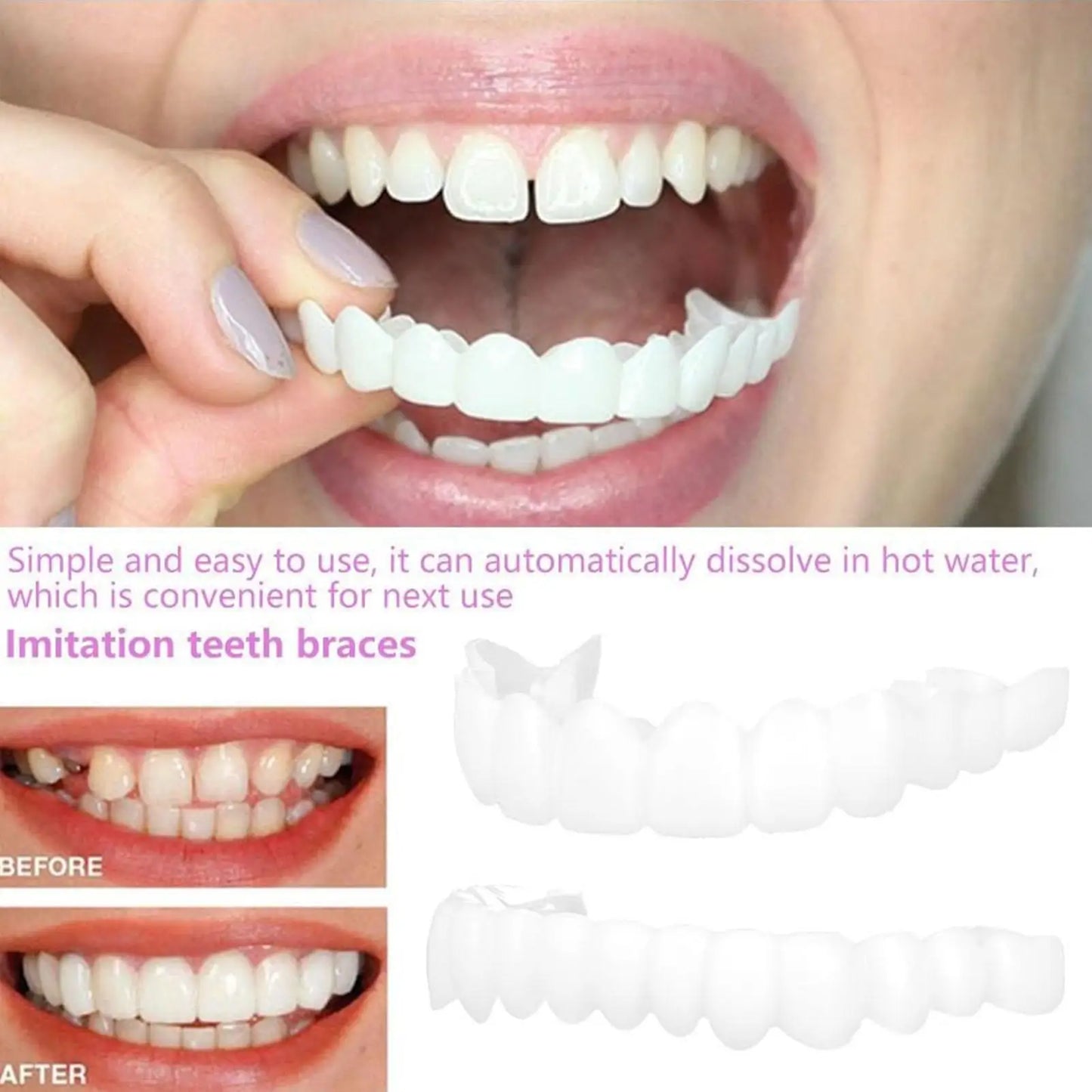 Dental Upper Lower Cover Bright Veneers Comfort Fit Flex Dentures Braces Whitening Replacement Smile Improver CK848-fro