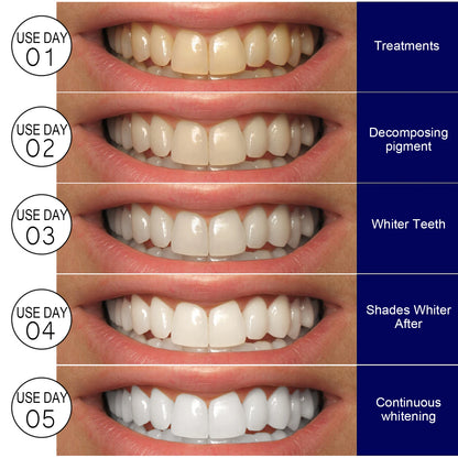 Teeth W-hitening Stickers Mint W-hite Teeth Gel Tooth W-hitener Strips Teeth Yellow Smoke Stains Tea Stains Oral Hygiene Care