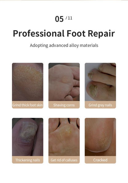 HOMEFISH Electric Foot Grinder Automatic Foot Callus Rubbing Pedicure Dead Skin Callus Remover for Foot Rechargeable Foot Beauty