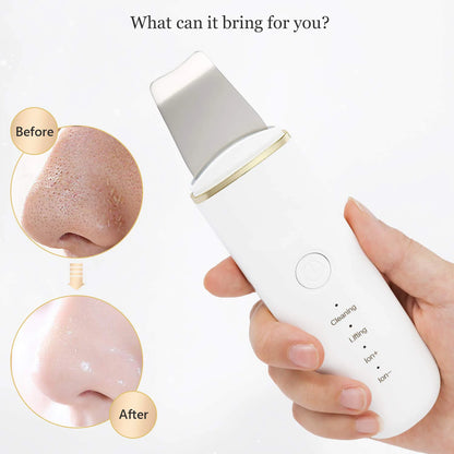 Ultrasonic Skin Scrubber Face Spatula Pore Cleaner Blackhead Remover Shovel Skin Care Tool for Facial Lifting and Deep Cleansing