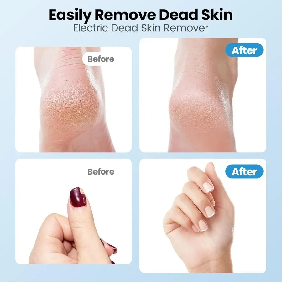 Electric Callus Remover for Feet 2 in 1 Electric Foot File Grinder Rechargeable Cordless Foot Scrubber for Dead Skin Adjustable