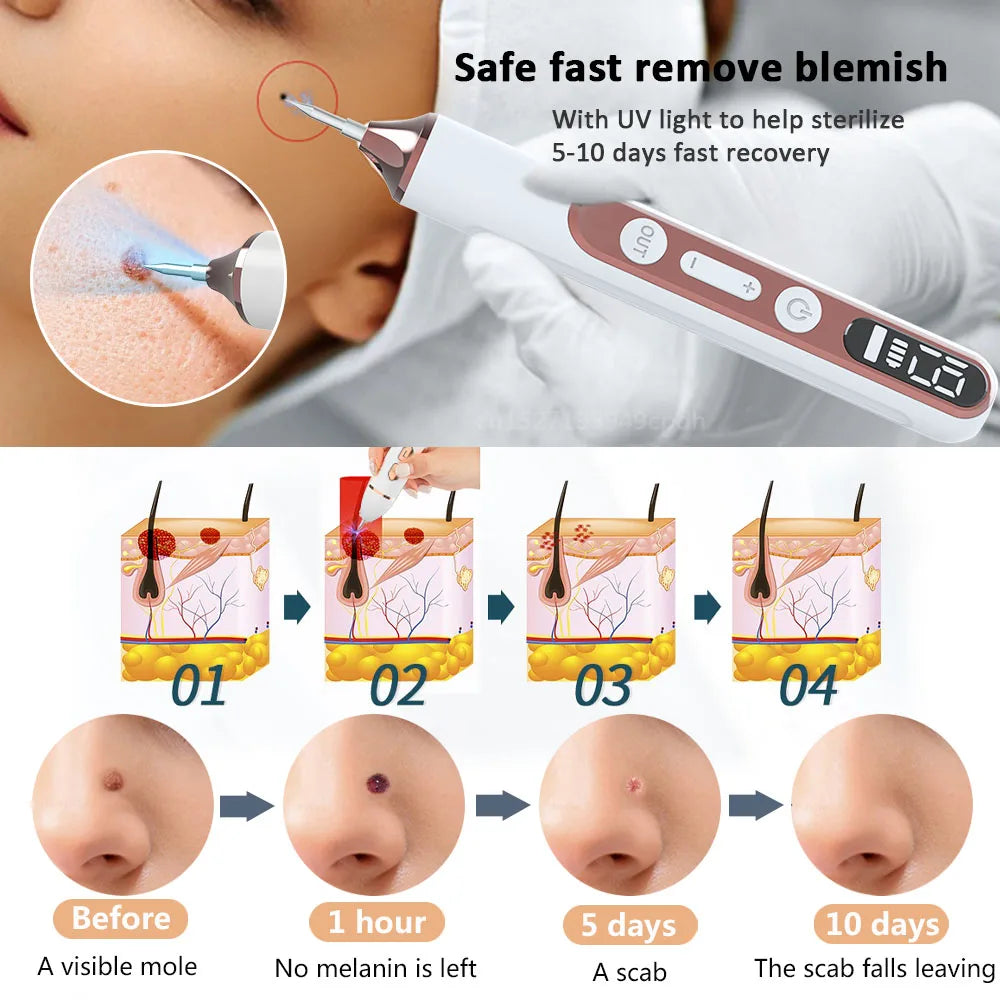 Plasma Pen Skin Tag Remover Mole Removal Wart Spots Dark Dpot Black Dot Nevus Freckle Flat Blemish Pimples Removal for Face Body