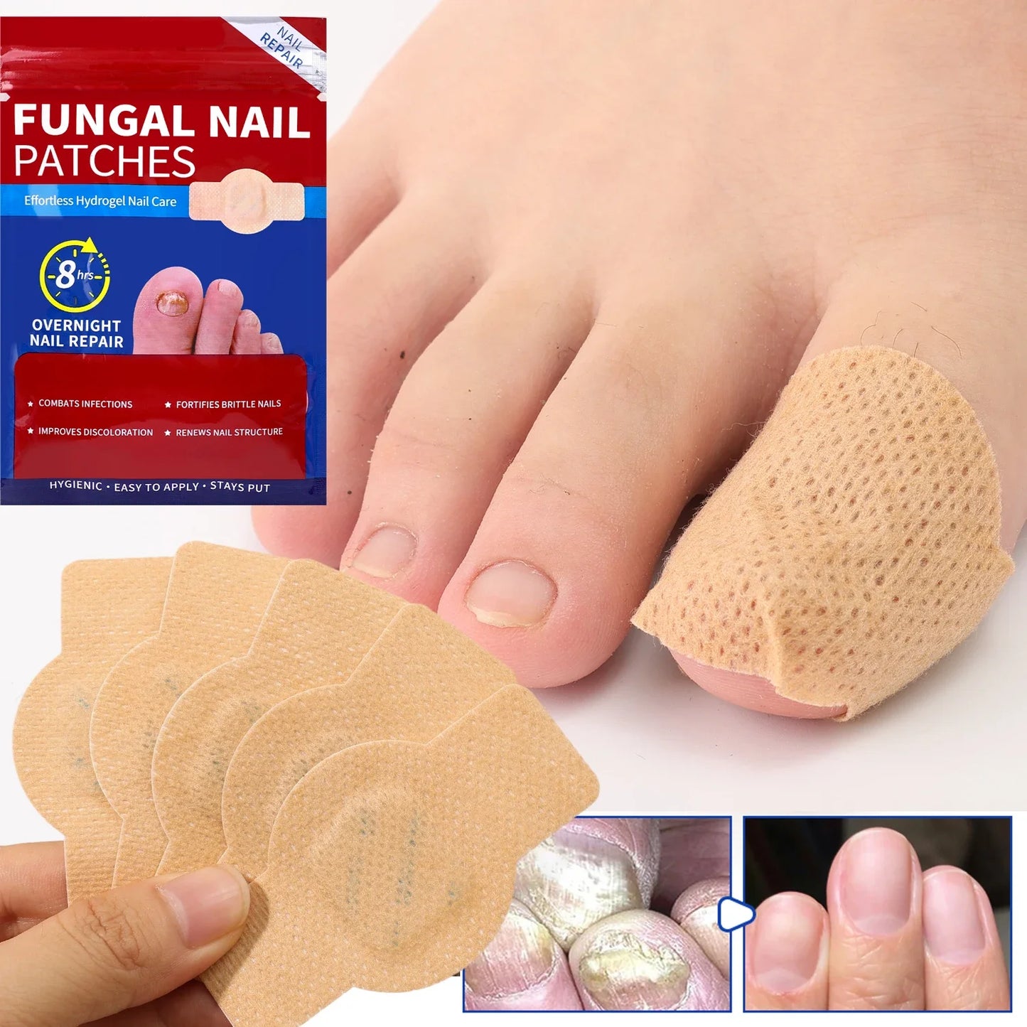 21pcs Nail Fungus Patch Waterproof Nail Repair Patch Ingrown Correction Sticker Damaged Nail Gray Care Patch Feet Care Tools