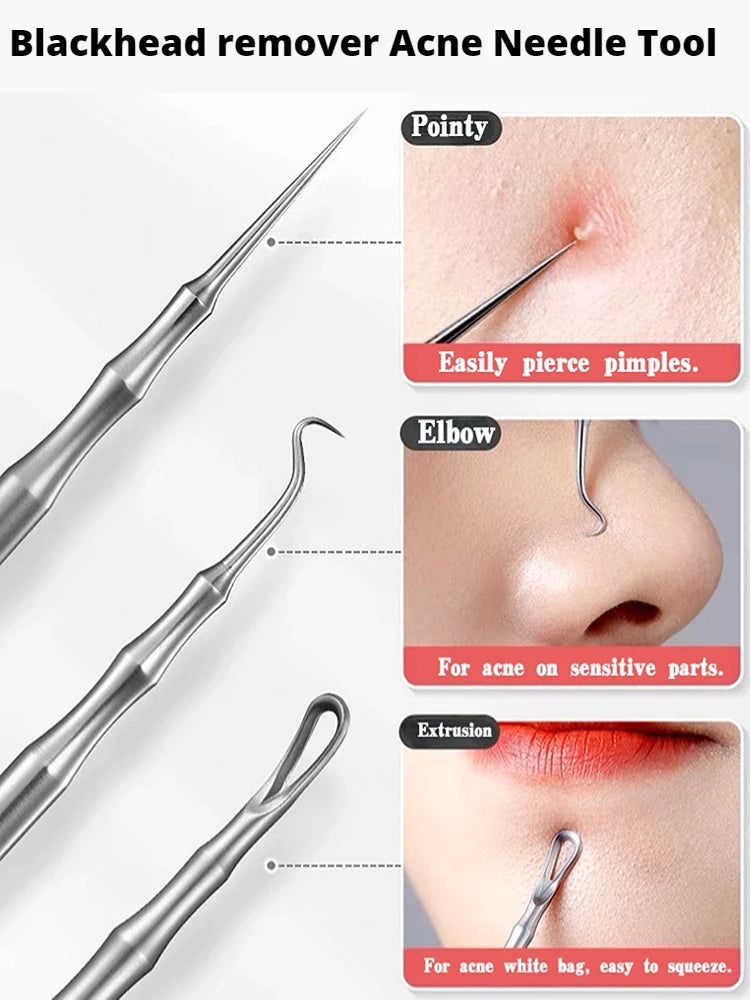 New German Acne Blackhead Removal Needles Pimples Blackhead Clip Tweezers Beauty Artifact Blemish Extractor Remover Needle Tool